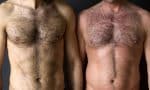 hairy-chest