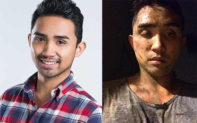 Employee of WeHo’s The Abbey Brutally Attacked in Hate Crime