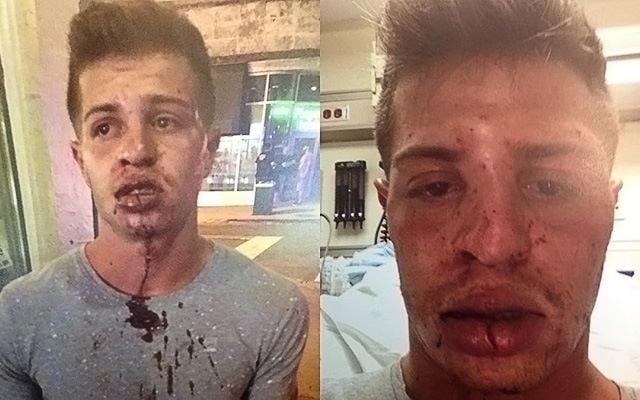 Homophobe Beats Man for Kissing Boyfriend at Burger King